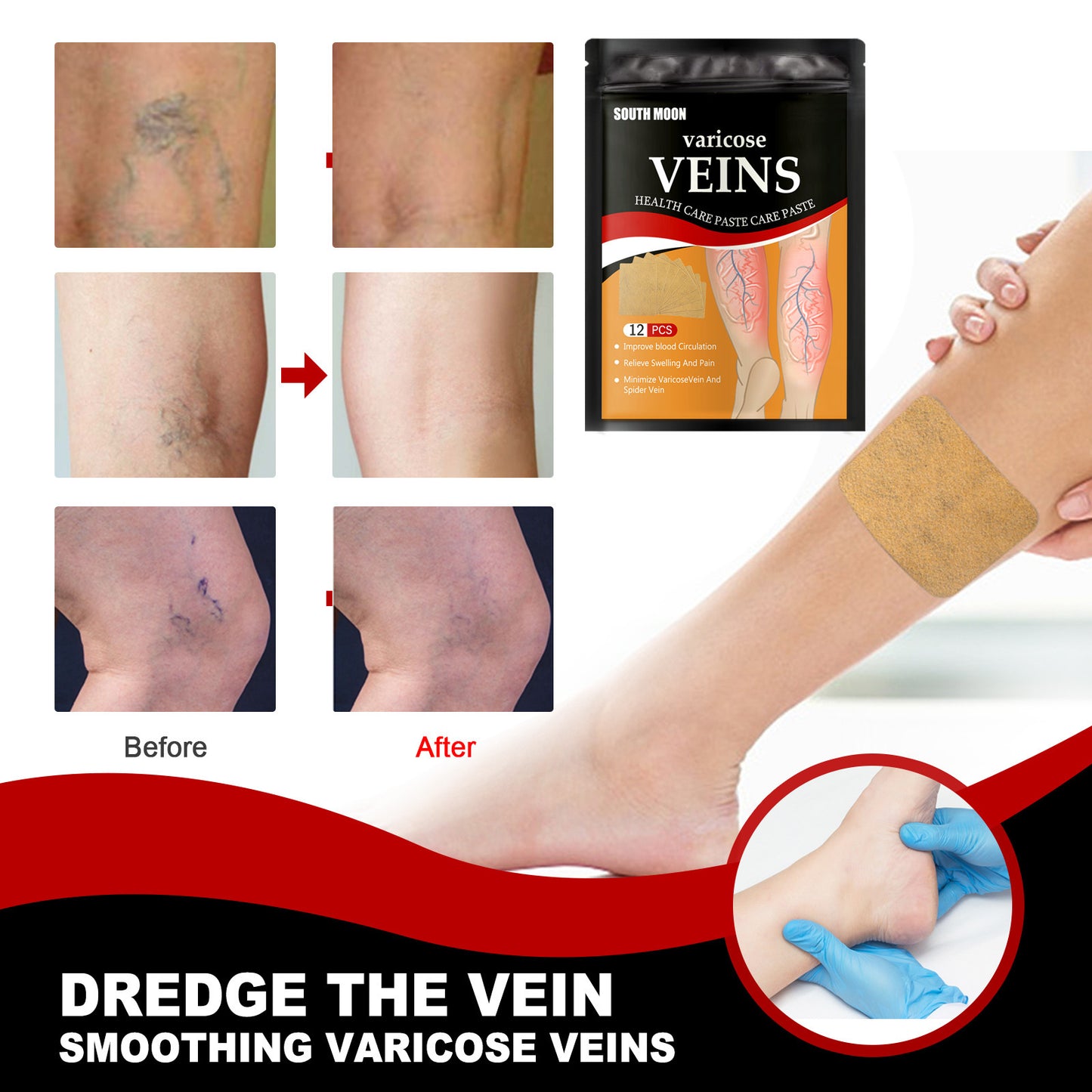 Foot Varicose Vein Relief Patch- Health & Body Care